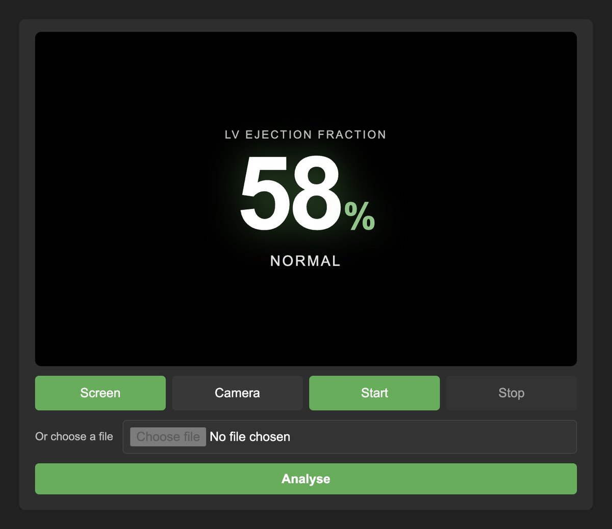 Auto EF after an apical 4-chamber clip. The stage reads LV ejection fraction 58 percent, category Normal. Screen is selected, Start is ready, and Analyse sits under the file chooser.